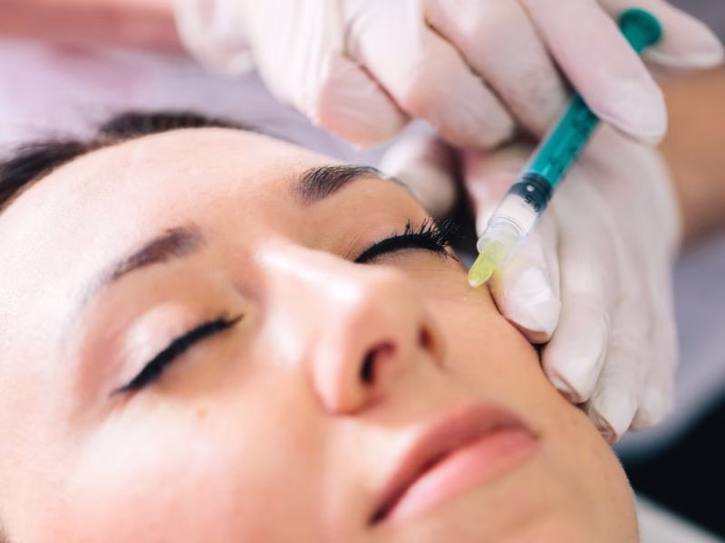 Dermatóloga especialista aplicando inyección de Sculptra en zona de mejillas y pómulos